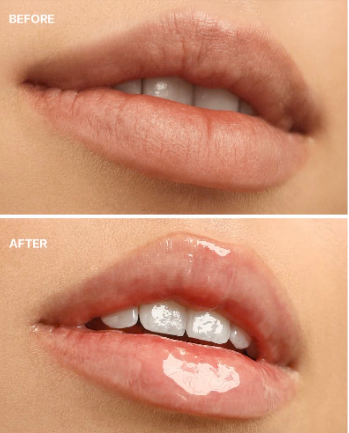 Lipper Rose